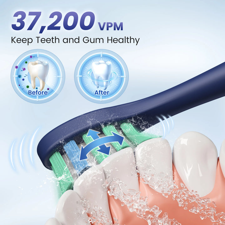 SEJOY Sonic Electric Toothbrush – 5 Modes, Smart Rechargeable IPX7