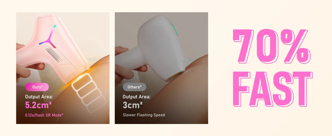 IPL Permanent Hair Removal Device – 990,000 Flashes, Painless Home Use