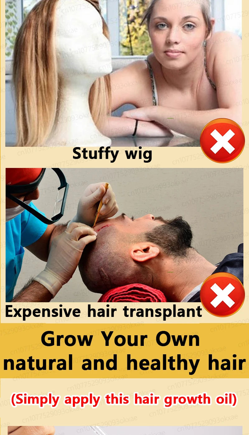 Baldness is no longer a concern. Grow thick, full hair with the help of this powerful formula.