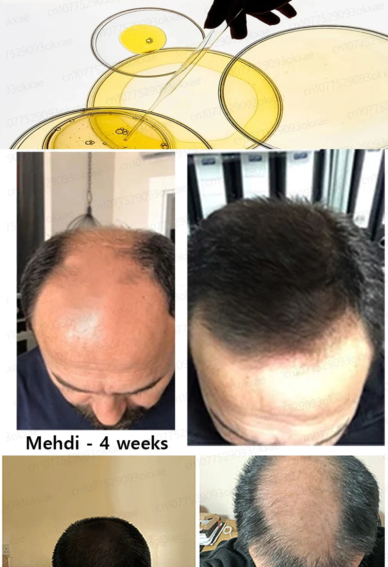 Baldness is no longer a concern. Grow thick, full hair with the help of this powerful formula.