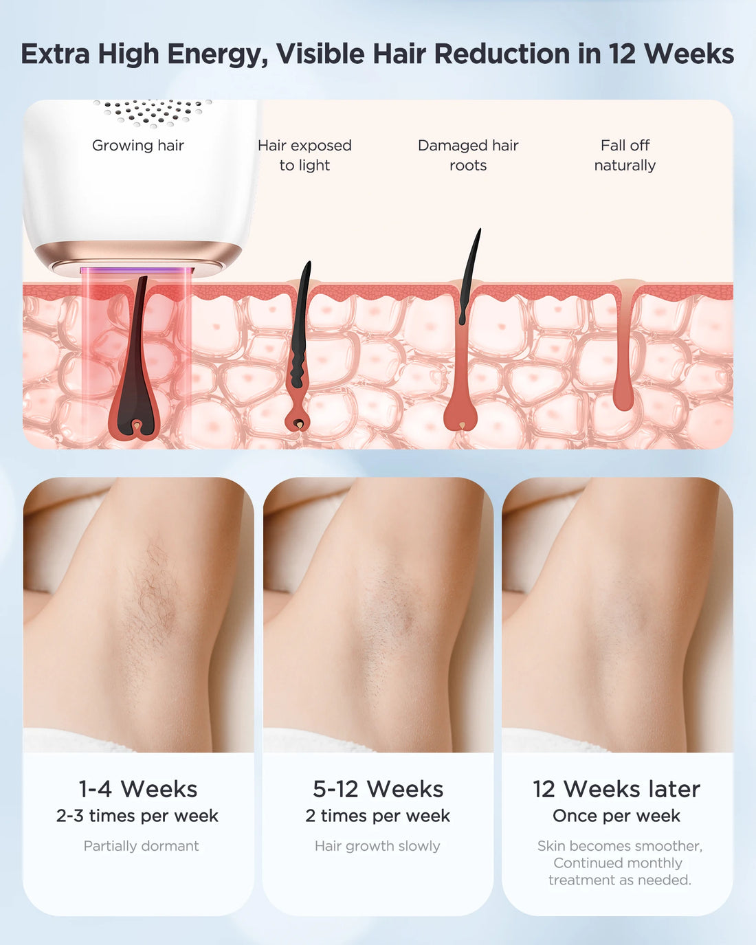 INNZA IPL Hair Removal – Painless, Ice Cooling Device for Men & Women