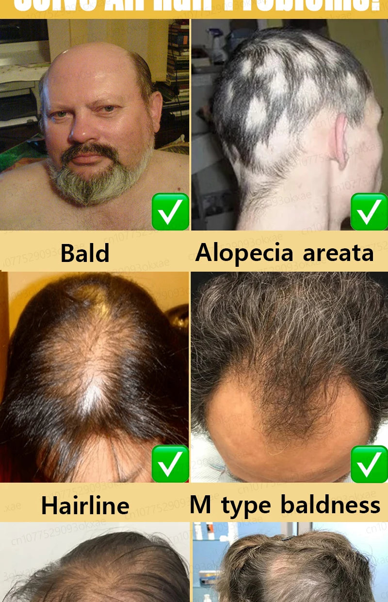 Baldness is no longer a concern. Grow thick, full hair with the help of this powerful formula.