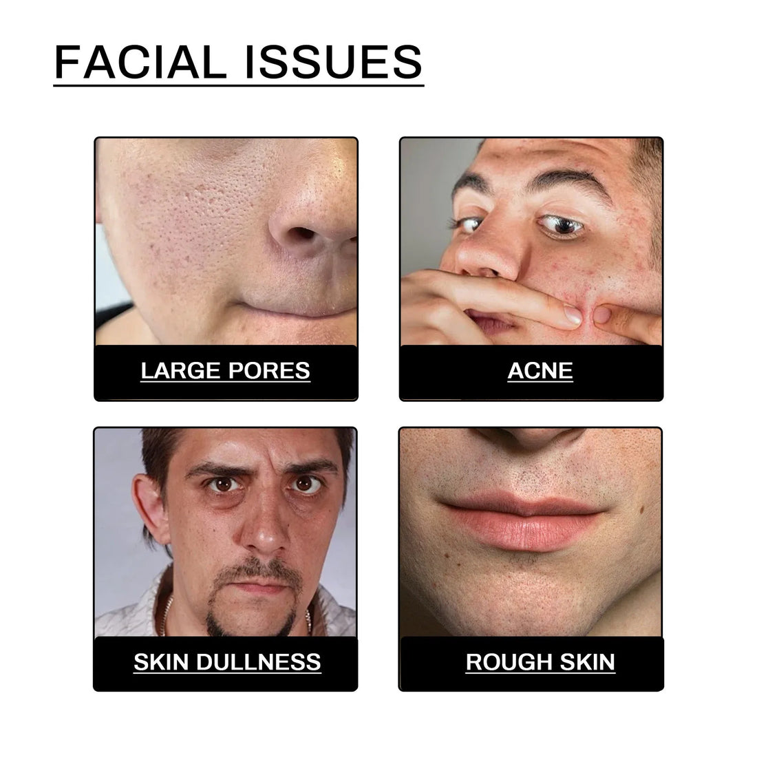 Men’s Facial Cleanser – Acne Control & Pore-Clearing Exfoliating Cream