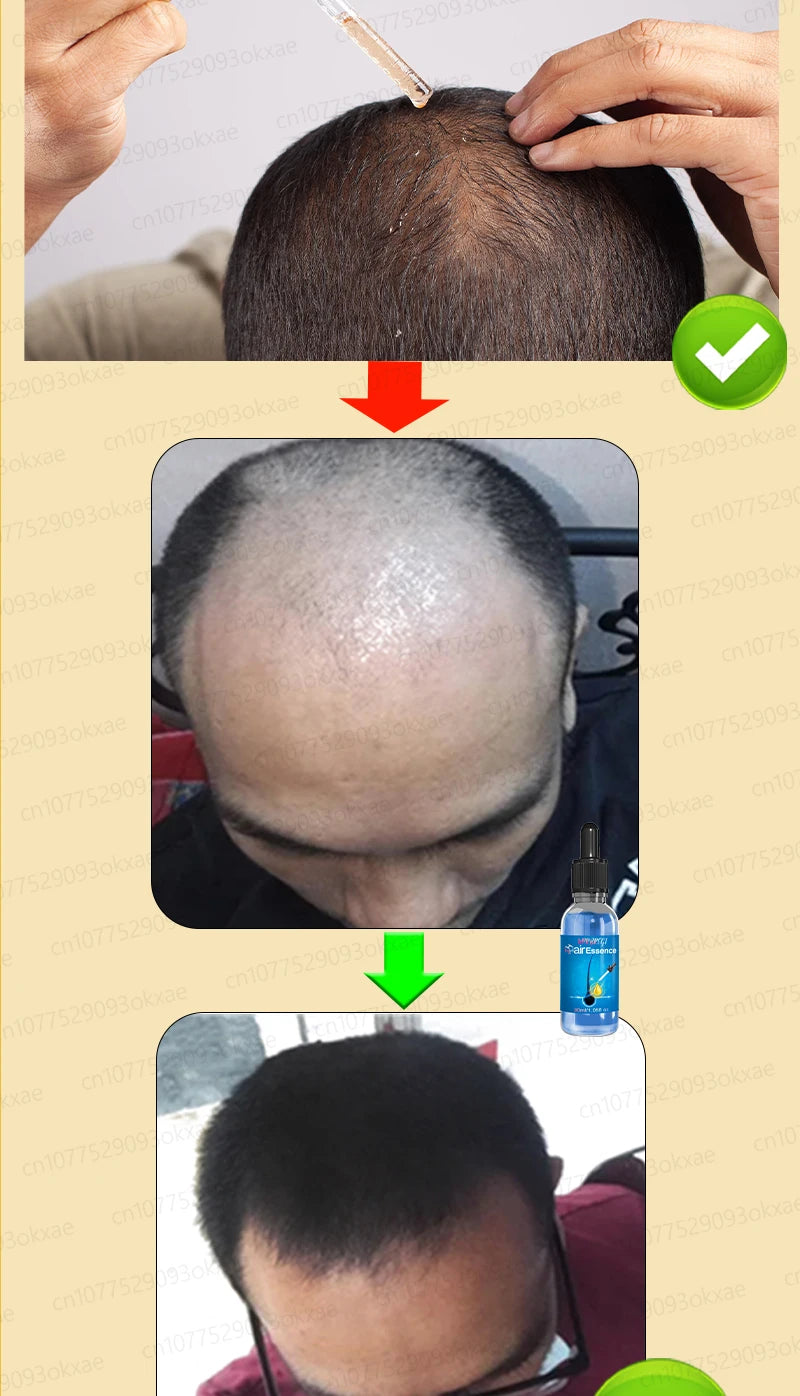 Baldness is no longer a concern. Grow thick, full hair with the help of this powerful formula.