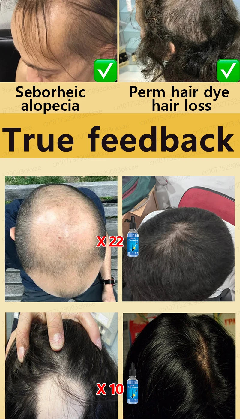 Baldness is no longer a concern. Grow thick, full hair with the help of this powerful formula.
