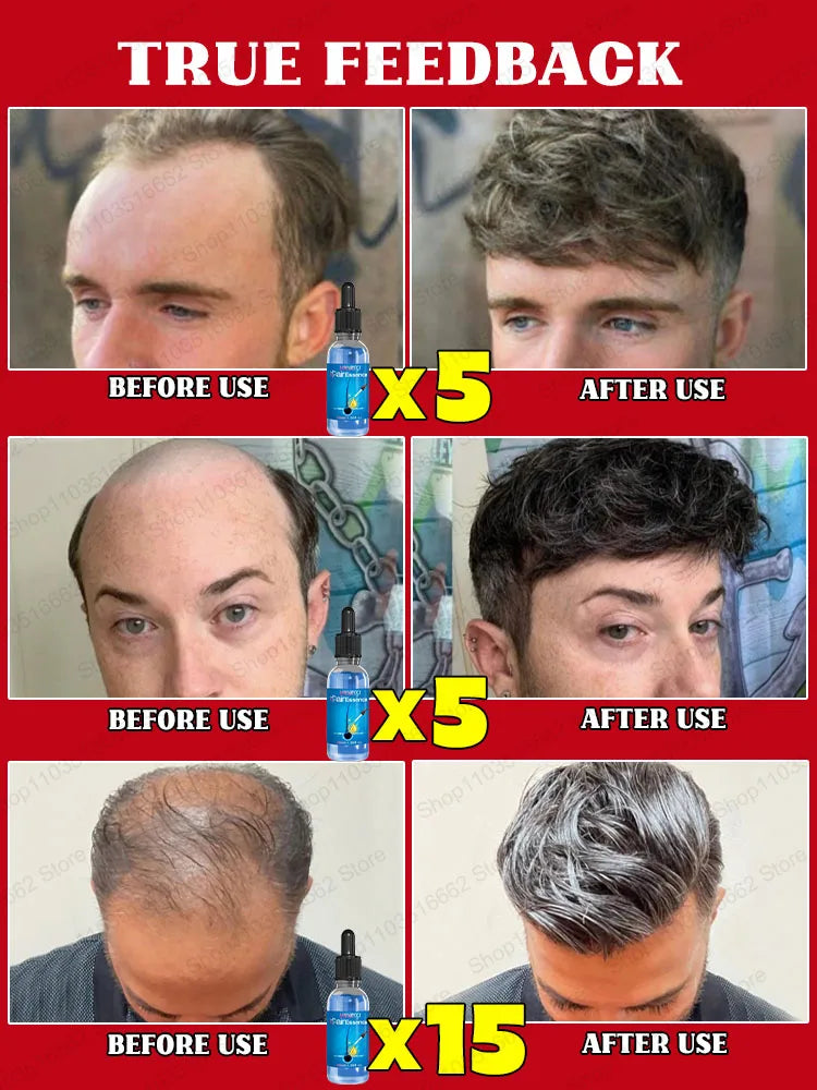 Baldness is no longer a concern. Grow thick, full hair with the help of this powerful formula.