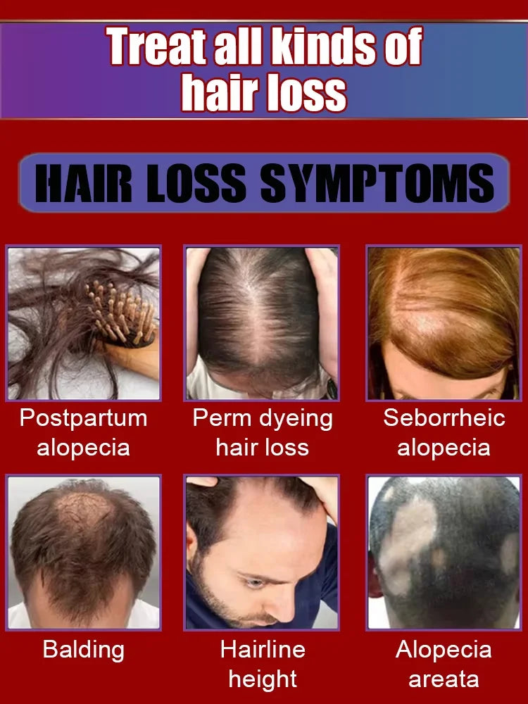Baldness is no longer a concern. Grow thick, full hair with the help of this powerful formula.