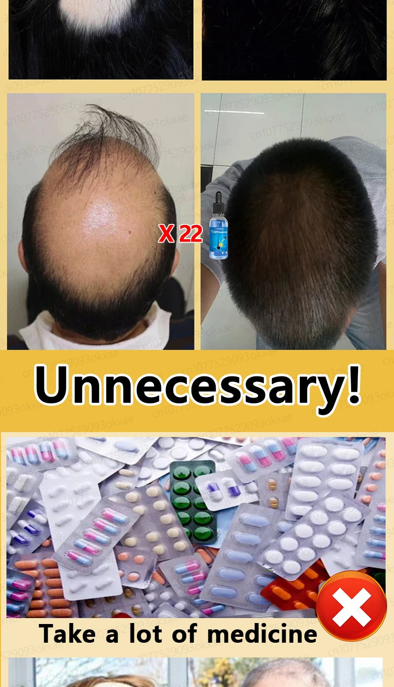 Baldness is no longer a concern. Grow thick, full hair with the help of this powerful formula.