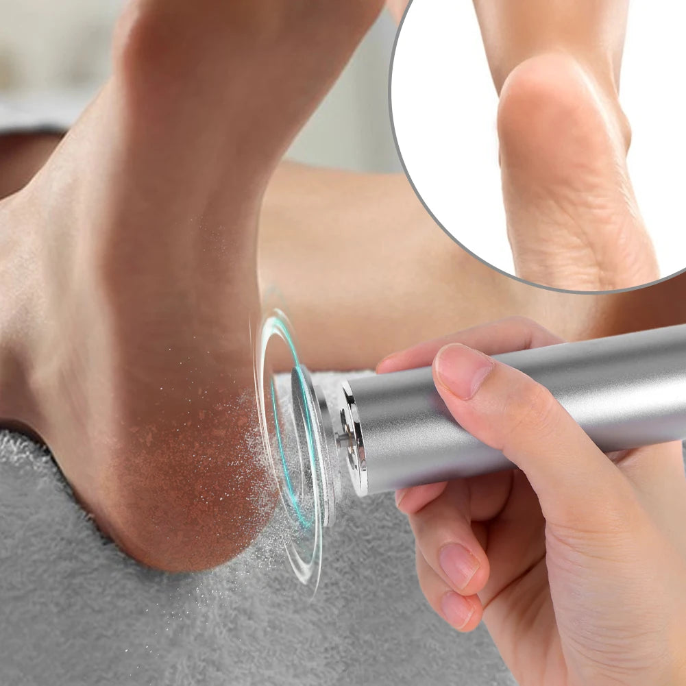 Electric Foot Callus Remover – Pedicure Tool with 60 Sandpaper Discs
