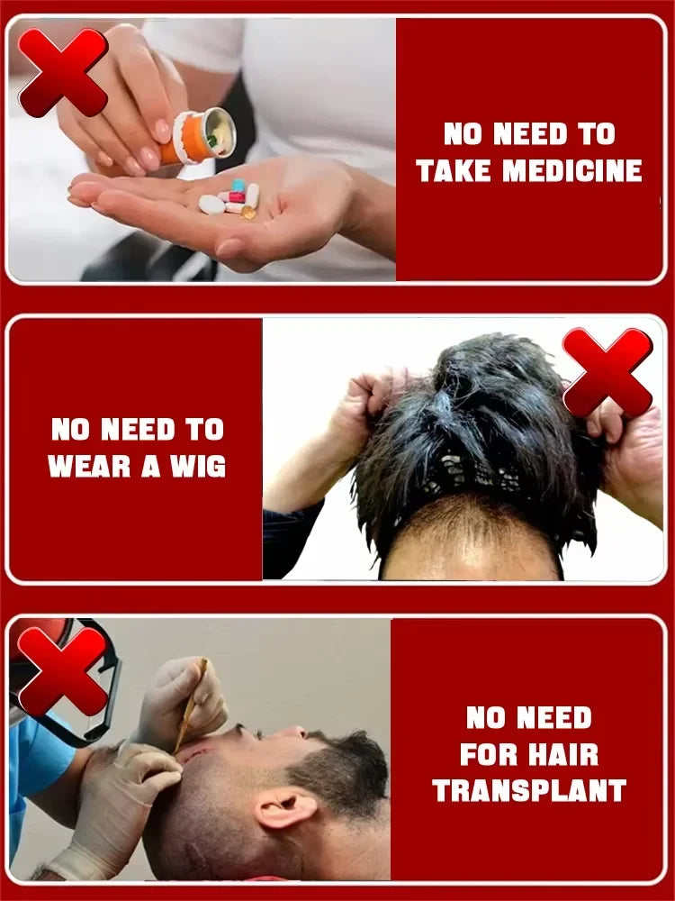 Baldness is no longer a concern. Grow thick, full hair with the help of this powerful formula.
