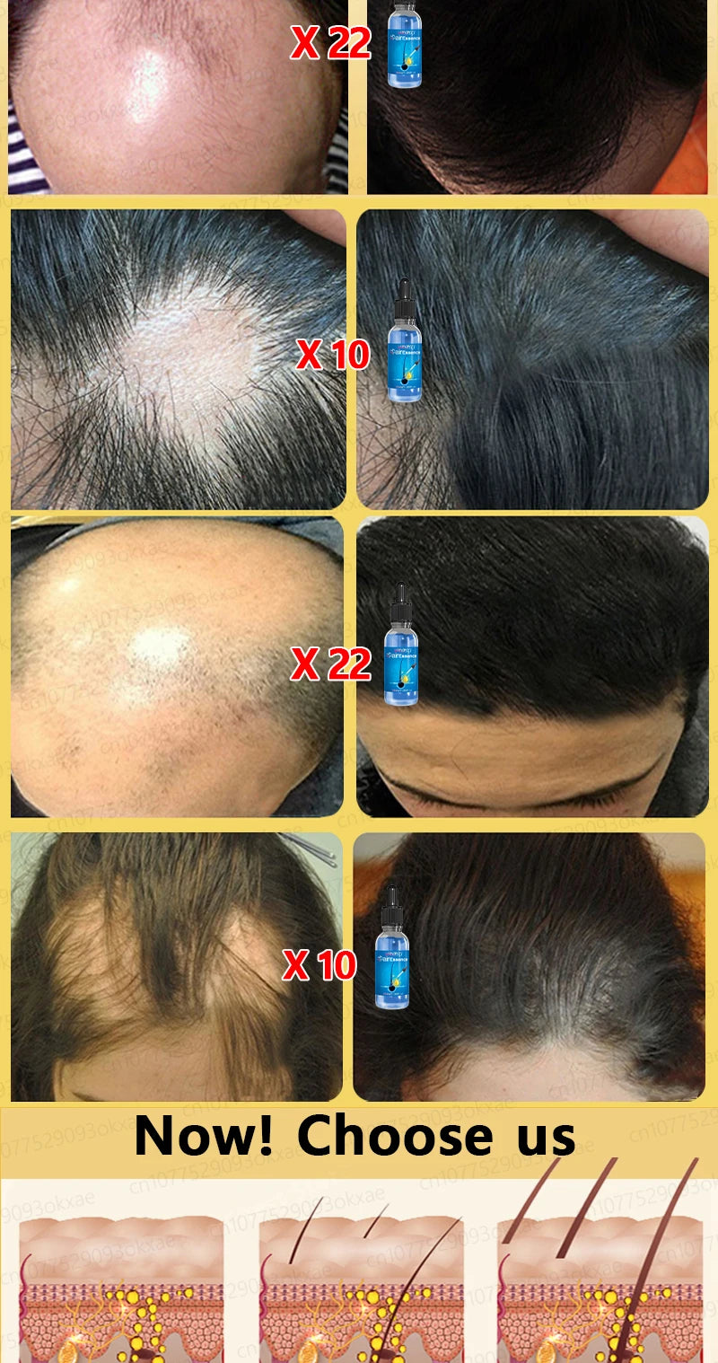 Baldness is no longer a concern. Grow thick, full hair with the help of this powerful formula.