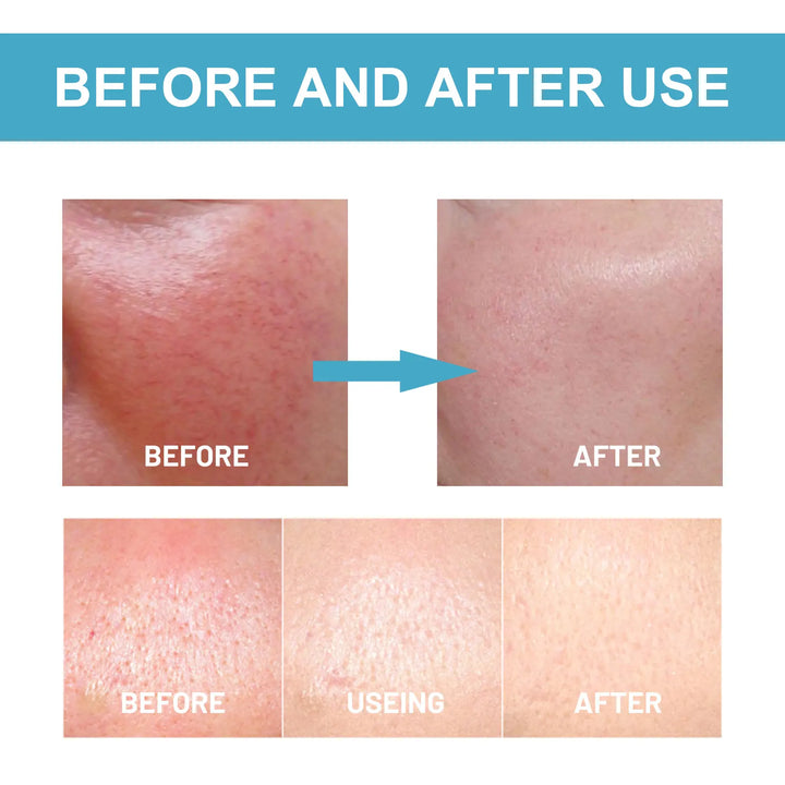Eelhoe Silky Fit Sunscreen Stick – Invisible, Lightweight SPF Protection