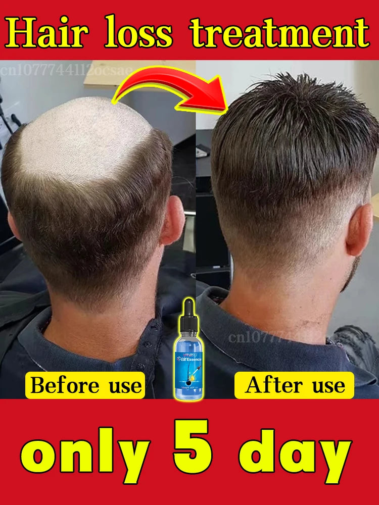 Baldness is no longer a concern. Grow thick, full hair with the help of this powerful formula.