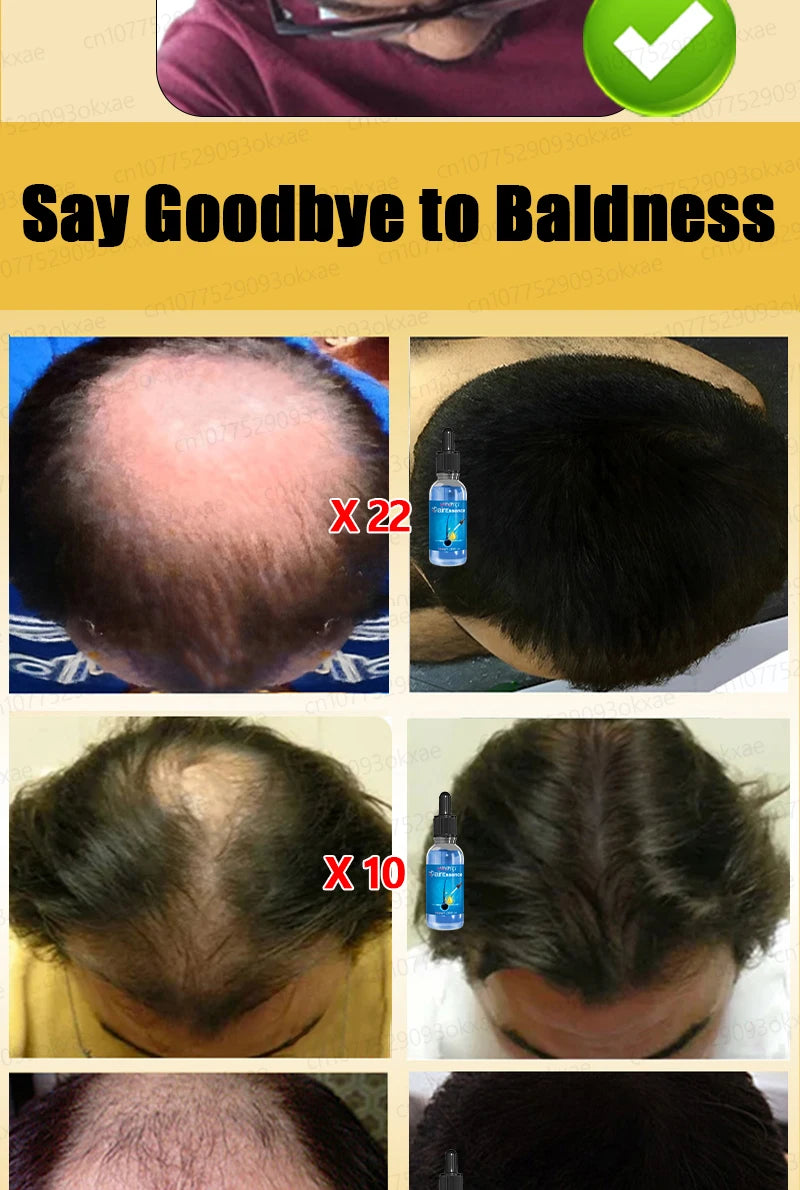 Baldness is no longer a concern. Grow thick, full hair with the help of this powerful formula.